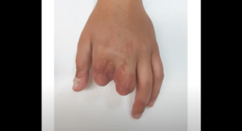 Utility Fingers Do The Job