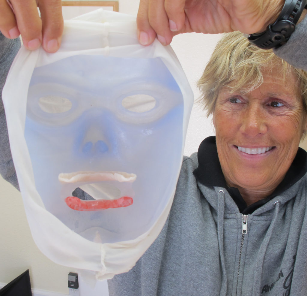 Image shows long-distance swimmer Diana Nyad holding the protective silicone mask custom-made for her by Aesthetic Prosthetics® for her swim from Cuba to Florida in 2013.