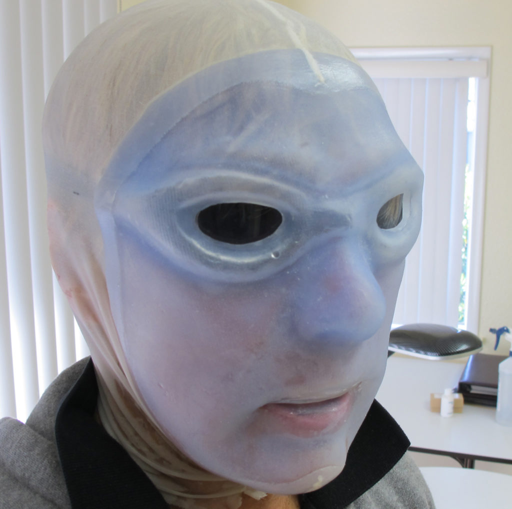 Image shows Diana Nyad, long-distance swimmer, trying on the custom-made silicone mask created for her by Aesthetics Prosthetics® Stefan Knauss