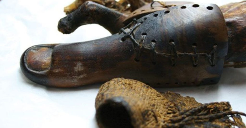 Ancient Prosthesis Discovered in Egypt